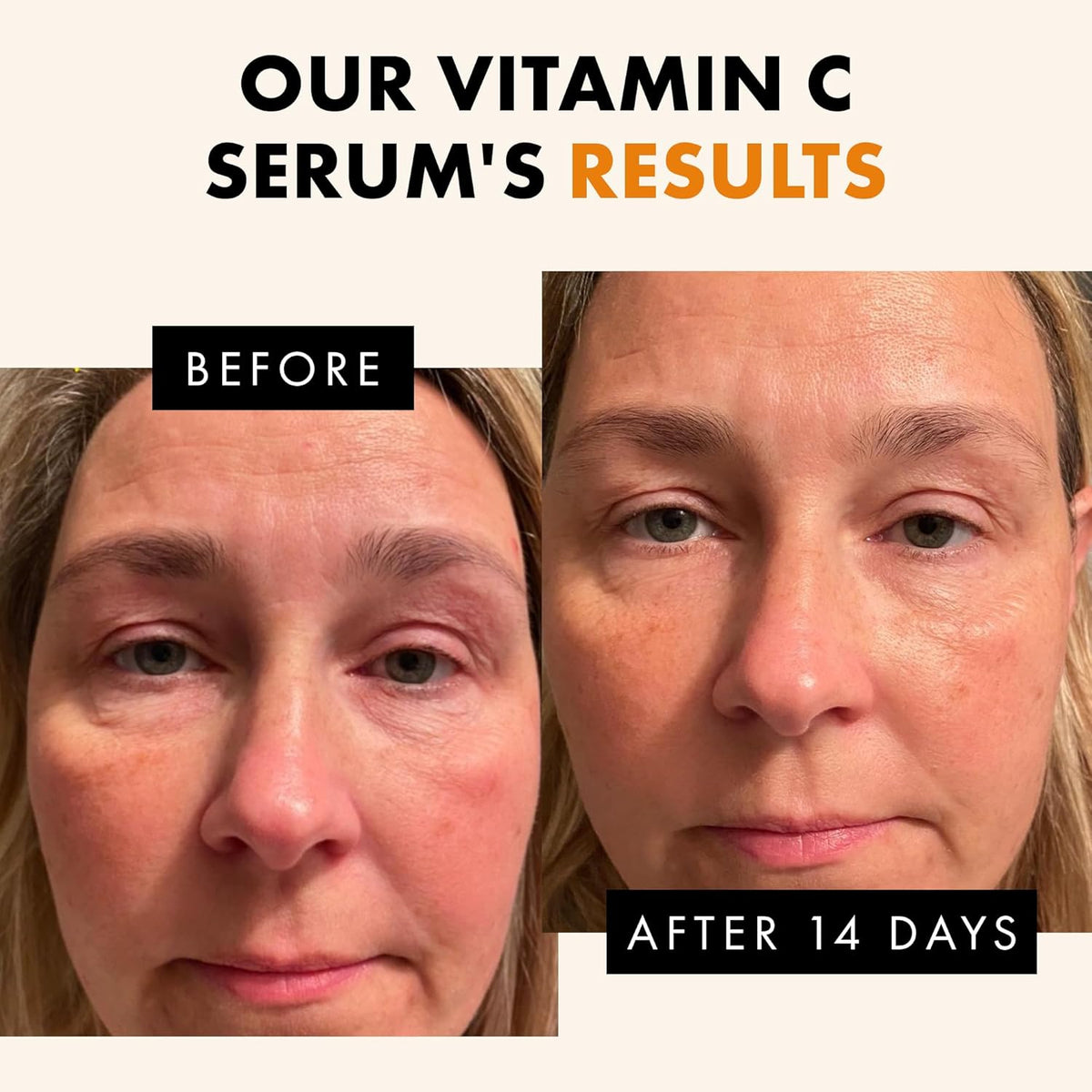 Eclat Skincare Vitamin C Serum - Skin Care for Dark Spots, Vitamin C Serum for Face with Hyaluronic Acid, Ferulic Acid, & Vit E - Anti Aging and Skin Brightening Vit C Formula for Face Care 1 Fl Oz