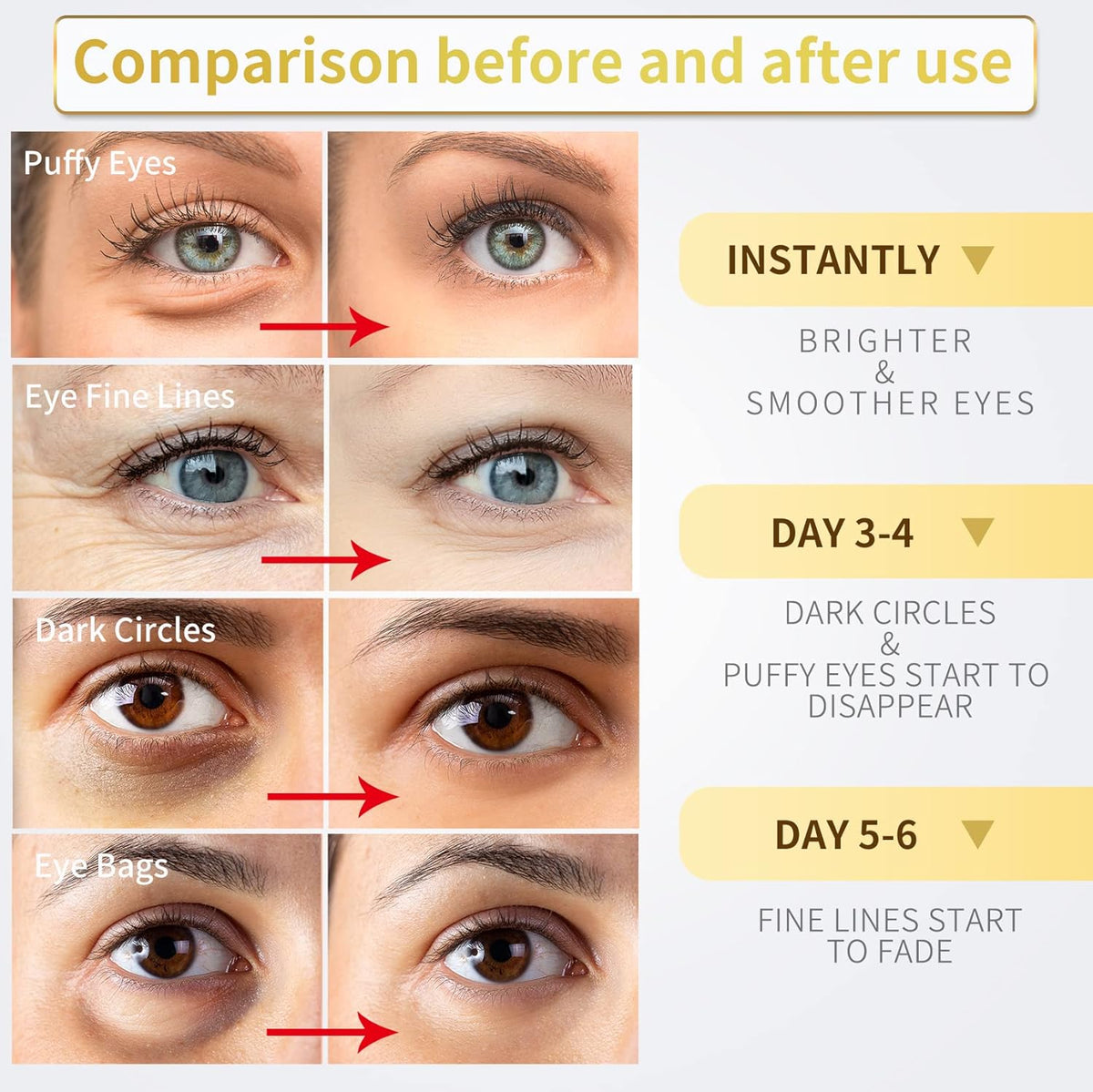 24K Gold Under Eye Patches – 60pcs for Dark Circles, Puffiness & Wrinkles Care