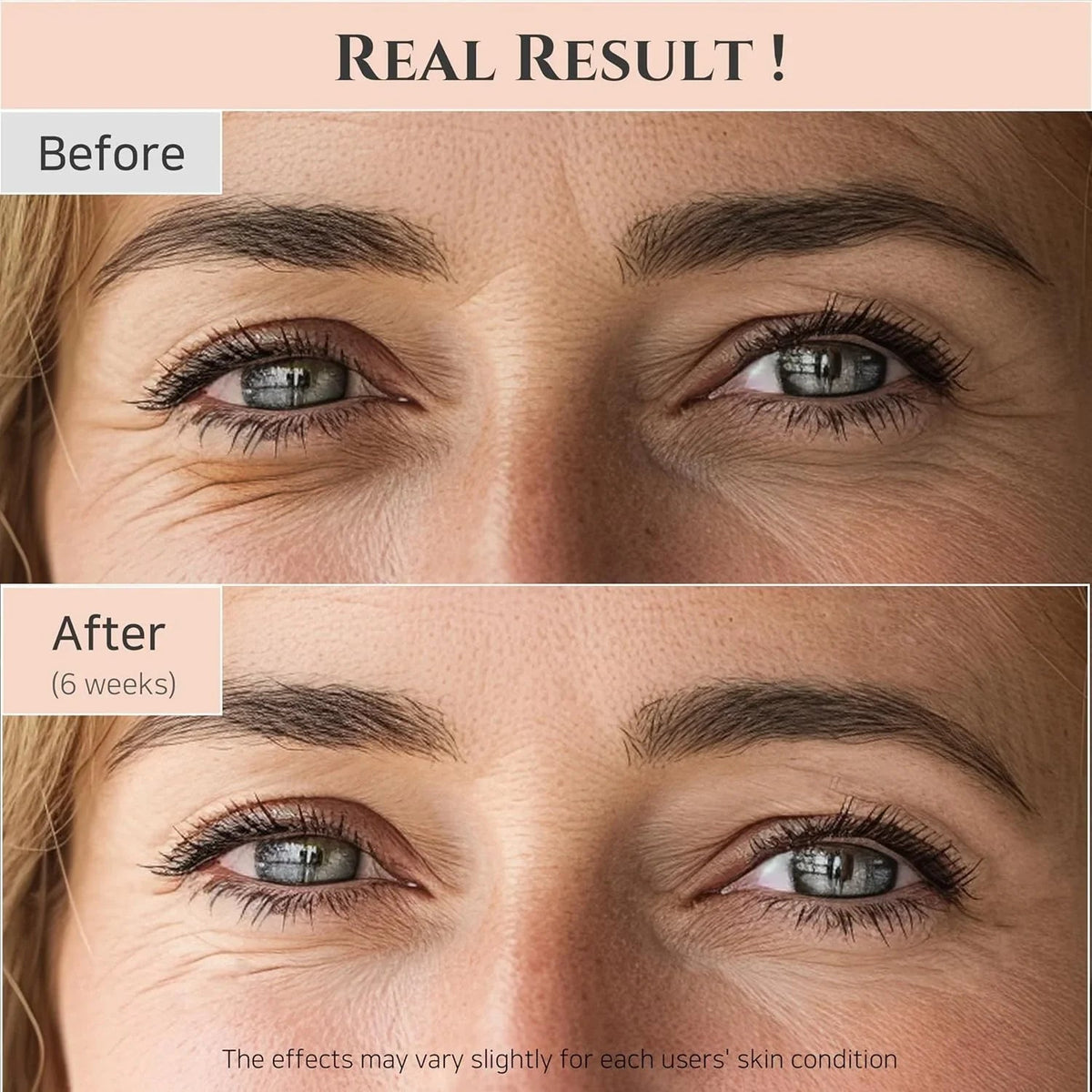 Beauty of Joseon Revive Eye Serum with Retinal Niacinamide Peptide for Face Under Eyes Wrinkles Dark Circles Moisturizer Cream Korean Skincare 30ml, 1 fl.oz * 2pack